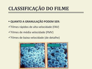 CLASSIFICAÇÃO DO FILME
 QUANTO A GRANULAÇÃO PODEM SER:
Filmes rápidos de alta velocidade (FAV)
Filmes de média velocidade (FMV)
Filmes de baixa velocidade (de detalhe)
 