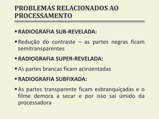 PROBLEMAS RELACIONADOS AO
PROCESSAMENTO
RADIOGRAFIA SUB-REVELADA:
Redução do contraste – as partes negras ficam
semitransparentes
RADIOGRAFIA SUPER-REVELADA:
As partes brancas ficam acinzentadas
RADIOGRAFIA SUBFIXADA:
As partes transparente ficam esbranquiçadas e o
filme demora a secar e por isso sai úmido da
processadora
 