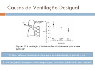 Causas de Ventilação Desigual As bases pulmonares recebem a maior parte do gás inspirado na posição ereta. A base tem pressão intrapleural menos negativa pois sofre muita influência do peso pulmonar 