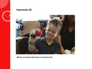 Impressão 3D
Menino usa prótese fabricada em impressora 3D
 
