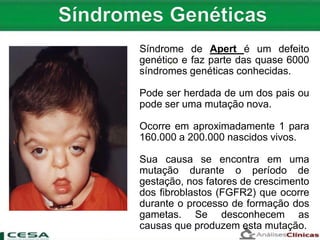 
Síndrome de Apert é um defeito
genético e faz parte das quase 6000
síndromes genéticas conhecidas.
Pode ser herdada de um dos pais ou
pode ser uma mutação nova.
Ocorre em aproximadamente 1 para
160.000 a 200.000 nascidos vivos.
Sua causa se encontra em uma
mutação durante o período de
gestação, nos fatores de crescimento
dos fibroblastos (FGFR2) que ocorre
durante o processo de formação dos
gametas. Se desconhecem as
causas que produzem esta mutação.
 