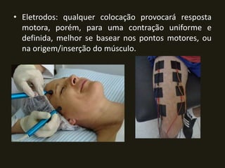 • Eletrodos: qualquer colocação provocará resposta
motora, porém, para uma contração uniforme e
definida, melhor se basear nos pontos motores, ou
na origem/inserção do músculo.
 