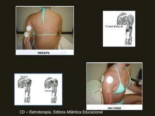 CD – Eletroterapia. Editora Atlântica Educacional
 