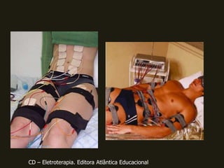 CD – Eletroterapia. Editora Atlântica Educacional
 