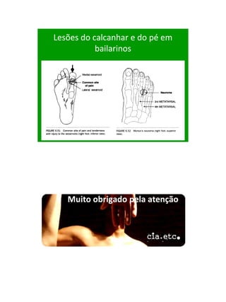 21/1/2011




Lesões do calcanhar e do pé em
           bailarinos




   Muito obrigado pela atenção




                                      106
 
