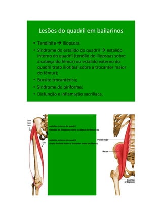 21/1/2011




  Lesões do quadril em bailarinos
• Tendinite  iliopsoas
• Síndrome do estalido do quadril  estalido
  interno do quadril (tendão do iliopsoas sobre
  a cabeça do fêmur) ou estalido externo do
  quadril trato iliotibial sobre a trocanter maior
  do fêmur);
• Bursite trocantérica;
• Síndrome do piriforme;
• Disfunção e inflamação sacriliaca.




        •estalido interno do quadril
        •(tendão do iliopsoas sobre a cabeça do fêmur) ou



        •estalido externo do quadril
        •(trato iliotibial sobre a trocanter maior do fêmur)




                                                                     41
 
