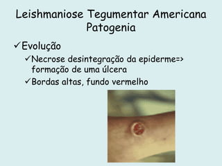 Leishmaniose Tegumentar Americana
Patogenia
Evolução
Necrose desintegração da epiderme=>
formação de uma úlcera
Bordas altas, fundo vermelho
 