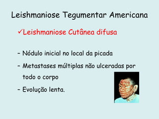 Leishmaniose Tegumentar Americana
Leishmaniose Cutânea difusa
– Nódulo inicial no local da picada
– Metastases múltiplas não ulceradas por
todo o corpo
– Evolução lenta.
 