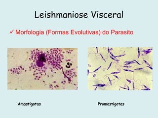 Leishmaniose Visceral
 Morfologia (Formas Evolutivas) do Parasito
PromastigotasAmastigotas
 