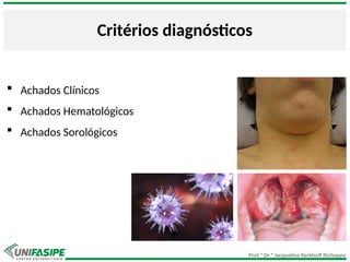 Prof.ª Dr.ª Jacqueline Kerkhoff Richoppo
Critérios diagnósticos
 Achados Clínicos
 Achados Hematológicos
 Achados Sorológicos
 