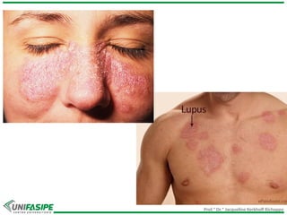 Prof.ª Dr.ª Jacqueline Kerkhoff Richoppo
 