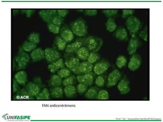 Prof.ª Dr.ª Jacqueline Kerkhoff Richoppo
FAN anticentrômero
 
