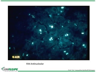 Prof.ª Dr.ª Jacqueline Kerkhoff Richoppo
FAN Antinucleolar
 