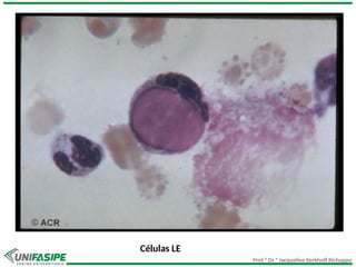 Prof.ª Dr.ª Jacqueline Kerkhoff Richoppo
Células LE
 