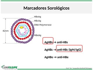 Prof.ª Dr.ª Jacqueline Kerkhoff Richoppo
Marcadores Sorológicos
AgHBs → anti-HBs
AgHBc → anti-HBc (IgM/IgG)
AgHBe → anti-HBe
 
