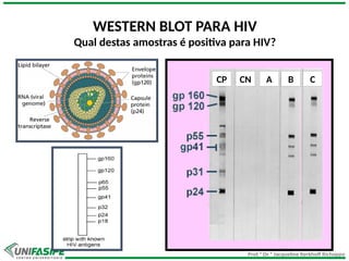 Prof.ª Dr.ª Jacqueline Kerkhoff Richoppo
WESTERN BLOT PARA HIV
Qual destas amostras é positiva para HIV?
CP CN A B C
 