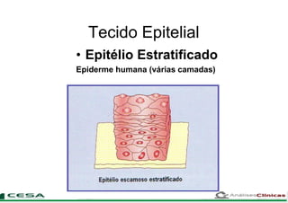 Tecido Epitelial
• Epitélio Estratificado
Epiderme humana (várias camadas)
 