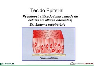 Tecido Epitelial
Pseudoestratificado (uma camada de
células em alturas diferentes)
Ex: Sistema respiratório
 
