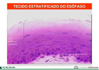 TECIDO ESTRATIFICADO DO ESÔFAGO
 