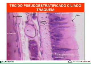 TECIDO PSEUDOESTRATIFICADO CILIADO
TRAQUÉIA
 