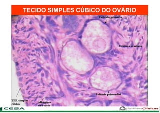 TECIDO SIMPLES CÚBICO DO OVÁRIO
 