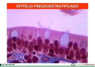 EPITÉLIO PSEUDOESTRATIFICADO
 
