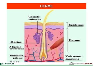 DERME
 
