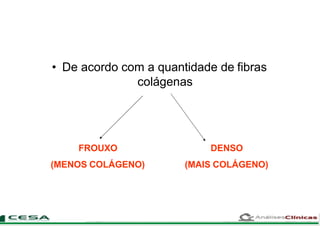 • De acordo com a quantidade de fibras
colágenas
FROUXO
(MENOS COLÁGENO)
DENSO
(MAIS COLÁGENO)
 