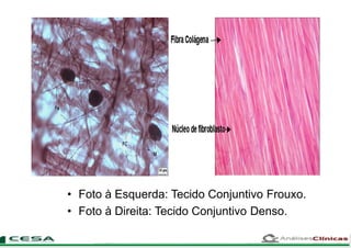 • Foto à Esquerda: Tecido Conjuntivo Frouxo.
• Foto à Direita: Tecido Conjuntivo Denso.
 