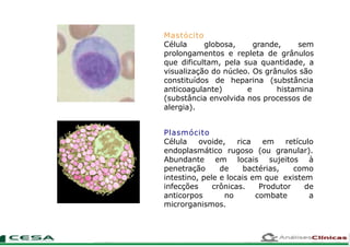 Mastócito
Célula globosa, grande, sem
prolongamentos e repleta de grânulos
que dificultam, pela sua quantidade, a
visualização do núcleo. Os grânulos são
constituídos de
anticoagulante)
heparina
e
(substância
histamina
(substância envolvida nos processos de
alergia).
Plasmócito
Célula ovoide,
endoplasmático
rica
rugoso
em retículo
(ou granular).
sujeitos àAbundante
penetração
em locais
de bactérias, como
intestino, pele e locais em que existem
infecções
anticorpos
crônicas.
no
Produtor de
combate a
microrganismos.
 
