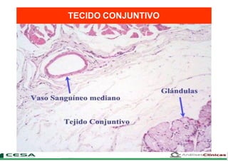 TECIDO CONJUNTIVO
 