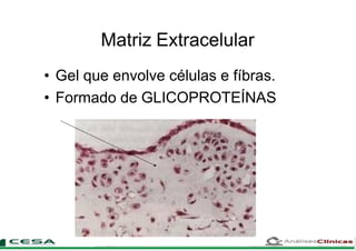 Matriz Extracelular
• Gel que envolve células e fíbras.
• Formado de GLICOPROTEÍNAS
 