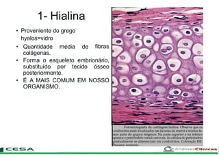 1- Hialina
fibras
• Proveniente do grego
hyalos=vidro
• Quantidade média de
colágenas.
• Forma o esqueleto embrionário,
substituído por tecido ósseo
posteriormente.
• É A MAIS COMUM EM NOSSO
ORGANISMO.
 