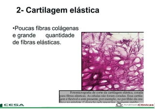 2- Cartilagem elástica
•Poucas fíbras colágenas
e grande quantidade
de fíbras elásticas.
 