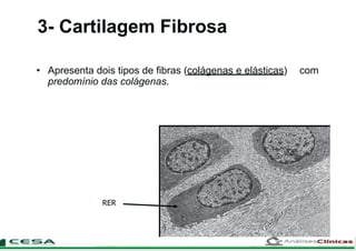 3- Cartilagem Fibrosa
• Apresenta dois tipos de fibras (colágenas e elásticas) com
predomínio das colágenas.
RER
 