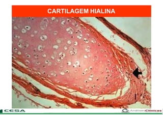 CARTILAGEM HIALINA
 