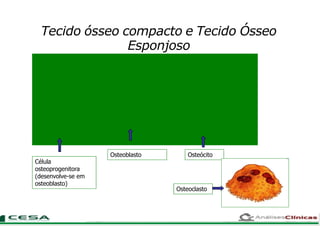Tecido ósseo compacto e Tecido Ósseo
Esponjoso
Célula
osteoprogenitora
(desenvolve-se em
osteoblasto)
Osteoblasto Osteócito
Osteoclasto
 