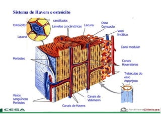 Sistema de Havers e osteócito
canalículos
Lamelas concênctricas Lacuna
Osso
Compacto
Vaso
linfático
Canal medular
Canais
Haversianos
Trabéculas do
osso
esponjoso
Periósteo
Canais de
Volkmann
Vasos
sangüíneos
Periósteo
Canais de Havers
Lacuna
Osteócito
 