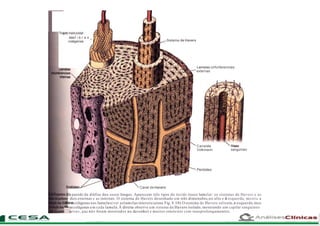Trajeto helicoidal
dasf i b r a s _
colágenas Sistema de Havers
Lamelas cirfunferenciais
externas
Canalde
Volkmann sanguíneo
Periósteo
Canal de Havers
da parede da diáfise dos ossos longos. Aparecem três tipos de tecido ósseo lamelar: os sistemas de Havers e as
dais externas e as internas. O sistema de Havers desenhado em três dimensões,no alto e à esquerda, mostra a
fibrascolágenas nas lamelas(ver aslamelas intersticiaisna Fig. 8.10).O sistema de Havers saliente,à esquerda,mos
fibrascolágenas em cada lamela.À direita observe um sistema de Havers isolado, mostrando um capilar sanguíneo
n
---ervos, que não foram mostrados no desenho) e muitos osteócitos com seusprolongamentos.
 