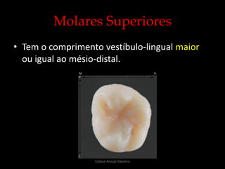 Molares Superiores
• Tem o comprimento vestíbulo-lingual maior
ou igual ao mésio-distal.
V
L
DM
Caíque Araujo Siqueira
 