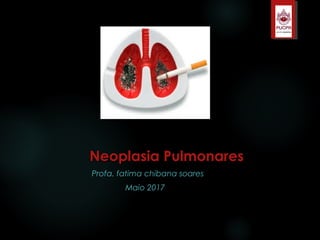 Neoplasia PulmonaresNeoplasia Pulmonares
Profa. fatima chibana soares
Maio 2017
 