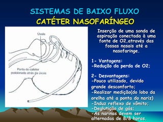 SISTEMAS DE BAIXO FLUXO
 CATÉTER NASOFARÍNGEO
              Inserção de uma sonda de
              aspiração conectada à uma
               fonte de O2,através das
                  fossas nasais até a
                     nasofaringe.

            1- Vantagens:
            -Redução da perda de O2;

            2- Desvantagens:
            -Pouco utilizado, devido
            grande desconforto;
            -Realizar medição(do lobo da
            orelha até a ponta do nariz)
            -Induz reflexo de vômito;
            -Deglutição de gás;
            -As narinas devem ser
            alternadas de 8/8 horas.
 