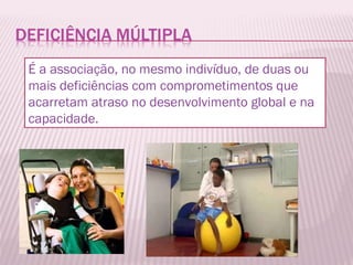 É a associação, no mesmo indivíduo, de duas ou mais deficiências com comprometimentos que acarretam atraso no desenvolvimento global e na capacidade. 