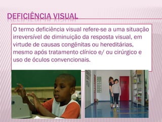 O termo deficiência visual refere-se a uma situação irreversível de diminuição da resposta visual, em virtude de causas co...