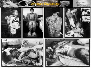 VÍTIMAS NAGASAKI
 