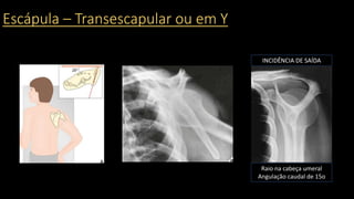 Escápula – Transescapular ou em Y
Raio na cabeça umeral
Angulação caudal de 15o
INCIDÊNCIA DE SAÍDA
 