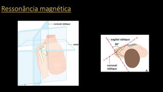 Ressonância magnética
 