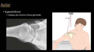 Axilar
• Superoinferior
• Cabeça do úmero e fossa glenóide
 