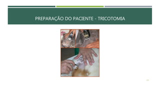 PREPARAÇÃO DO PACIENTE - TRICOTOMIA
120
 