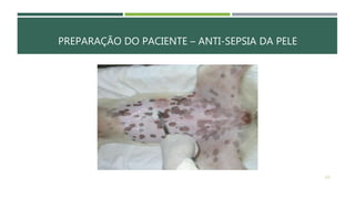 PREPARAÇÃO DO PACIENTE – ANTI-SEPSIA DA PELE
125
 